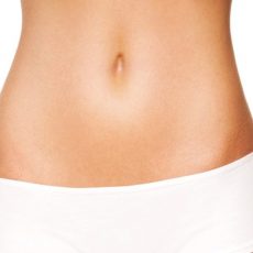 Abdominoplastia