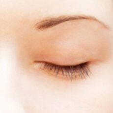 Blefaroplastia