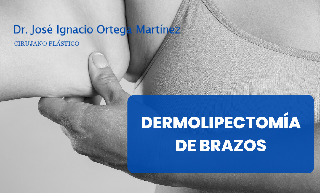 Dermolipectomía de brazos en Sevilla