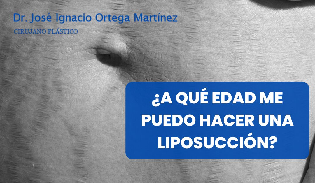 A qué edad me puedo hacer una liposucción