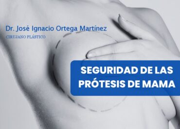 Seguridad de las prótesis de mama: Lo que dice la evidencia científica