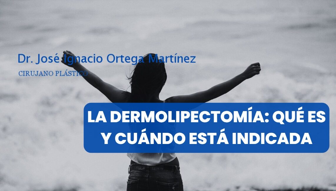 La dermolipectomía: qué es y cuándo está indicada