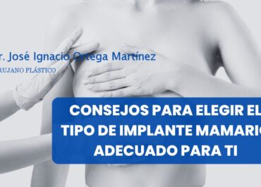 Consejos para elegir el tipo de implante mamario adecuado para ti