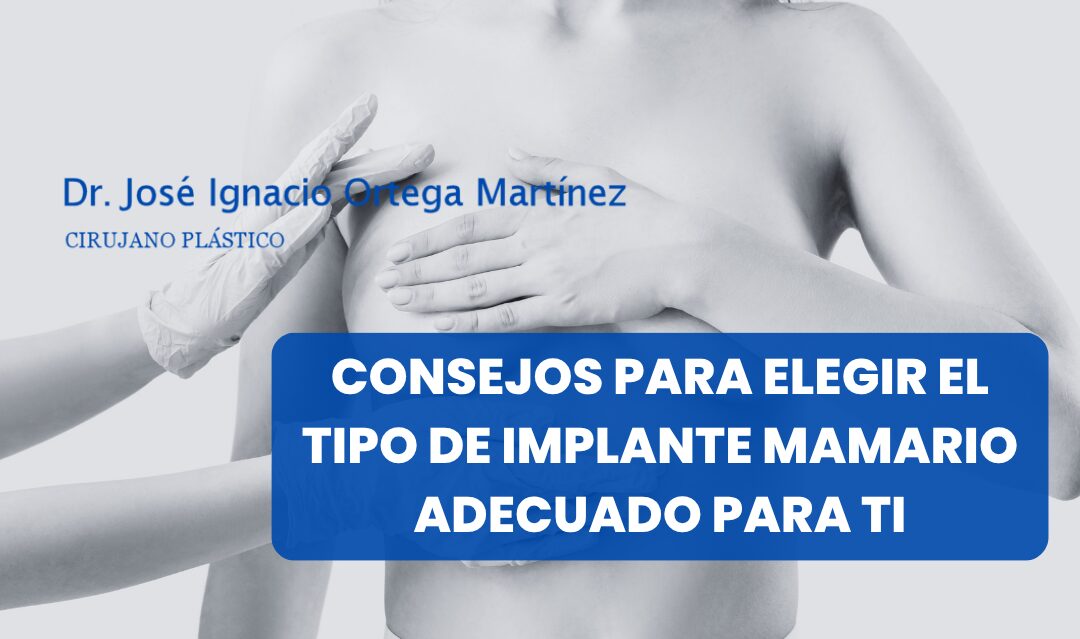 Consejos para elegir el tipo de implante mamario adecuado para ti